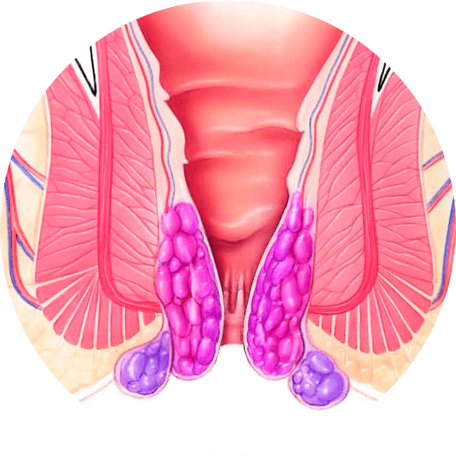 A Gelarex az első használattól kezdve enyhíti a tüneteket